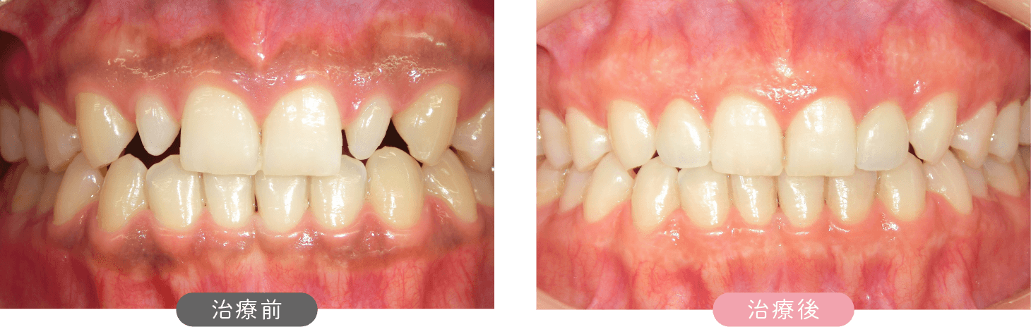 治療前後