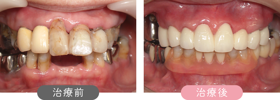 治療前後